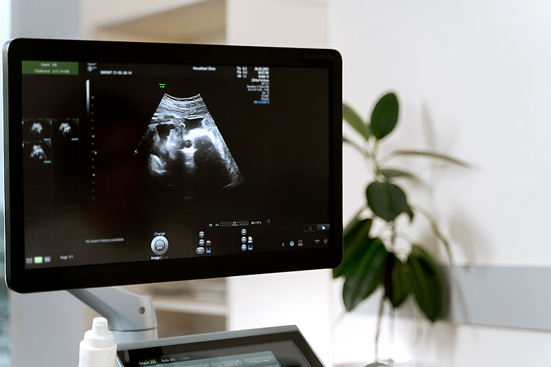 Ultraschalluntersuchung für Schwangere